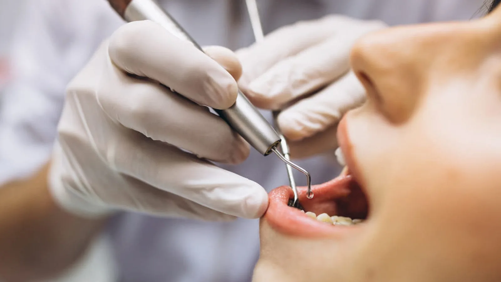 Precio de mejora estética y funcional de la sonrisa en Monterrey, Nuevo León