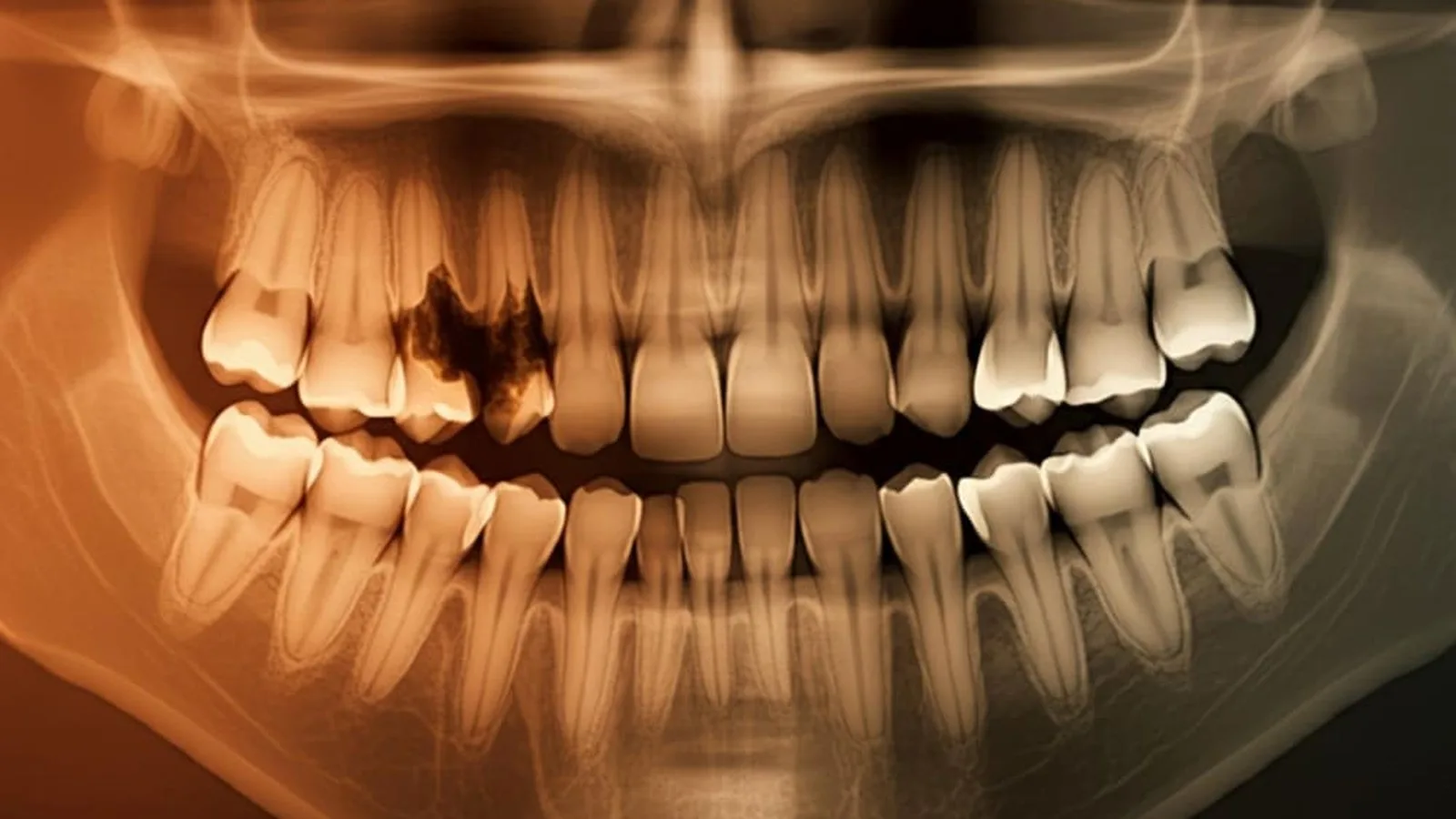 Precio de radiografía dental para ortodoncia en Monterrey, Nuevo León