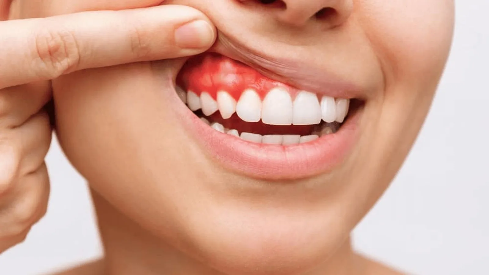 Soluciones ortodónticas para problemas estéticos dentales en Monterrey